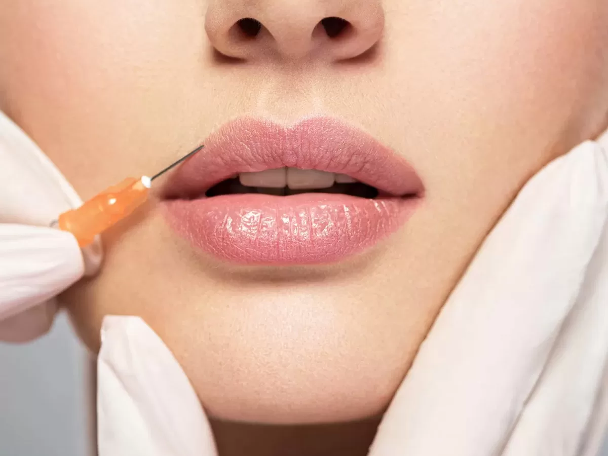 female receiving lip filler