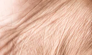 close up of crepey skin