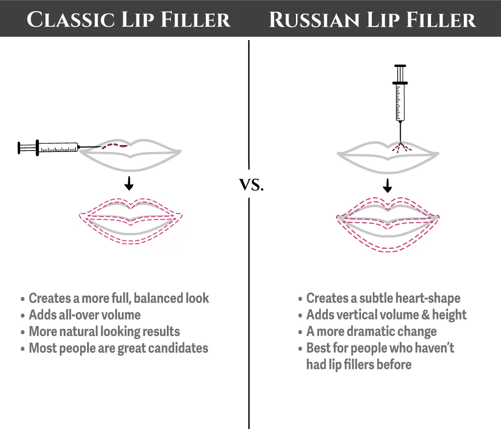 Diagram of Russian Lips Technique