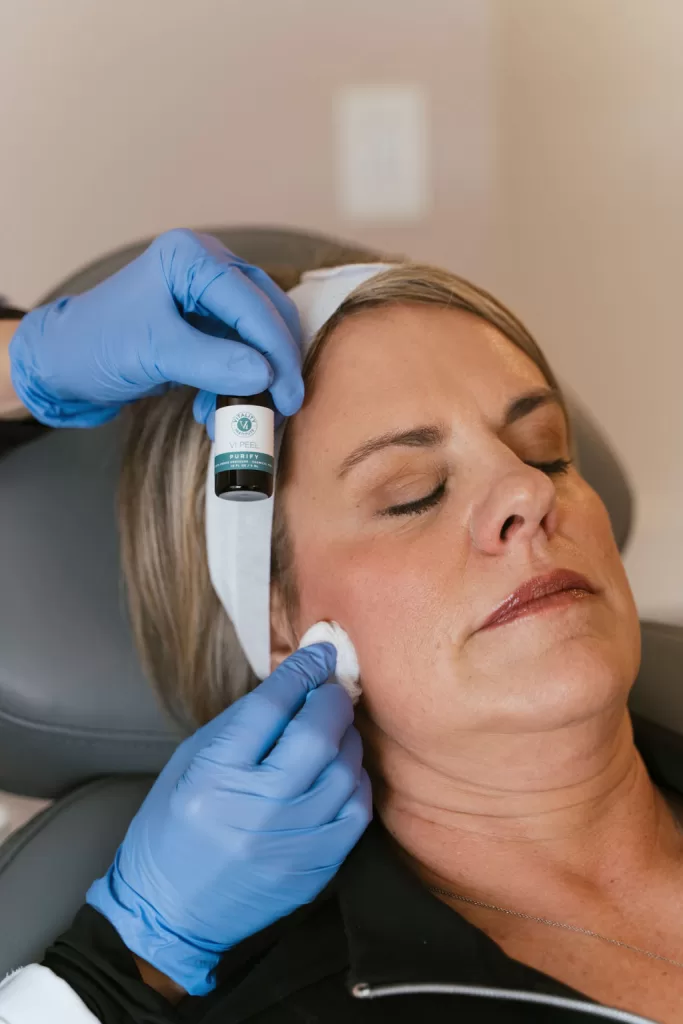provider applying chemical peel solution on a patients face