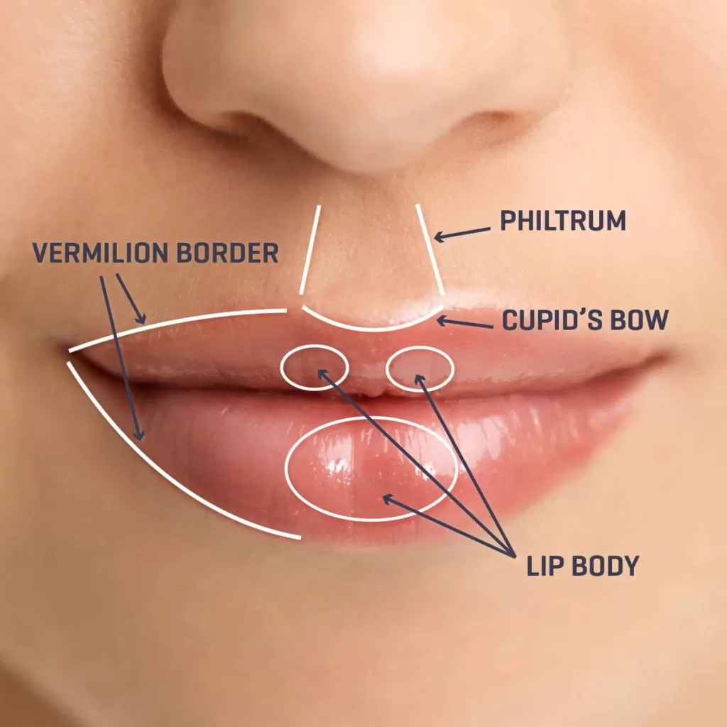 Lip Flip Treatment Areas