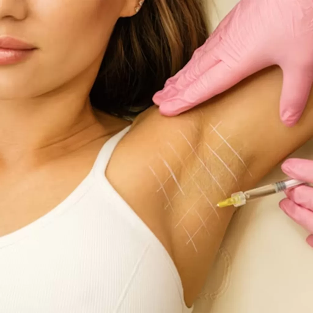 photo of female having botox injected under arms for treatment of hyperhidrosis