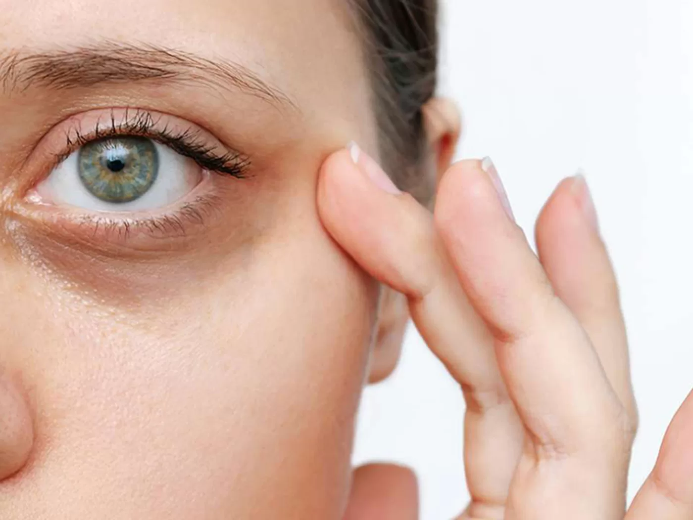 How to get rid of Sunken Eyes, Hollow Eyes & Dark Circles Direct