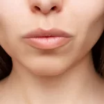 close up of femal with sunken hollow cheeks caused from weight loss