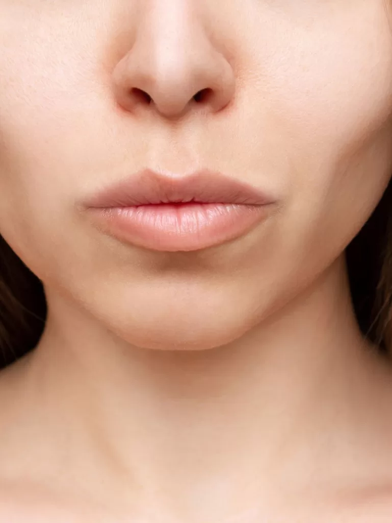 close up of femal with sunken hollow cheeks caused from weight loss