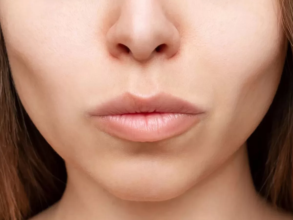close up of female with sunken hollow cheeks caused from weight loss