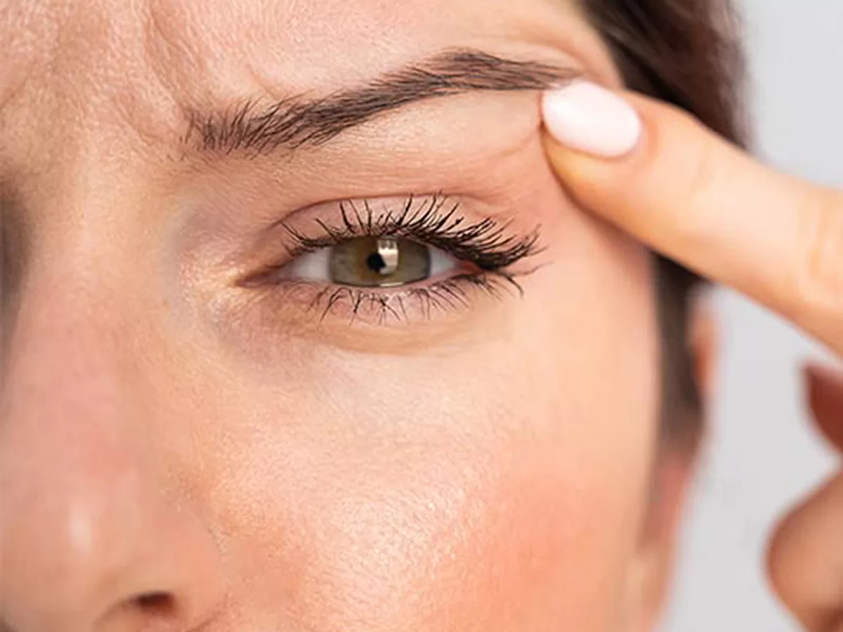 female holding up droopy eye lid