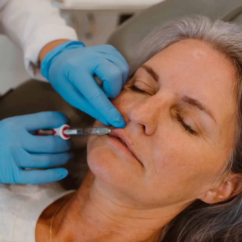female receiving botox for treating lip lines