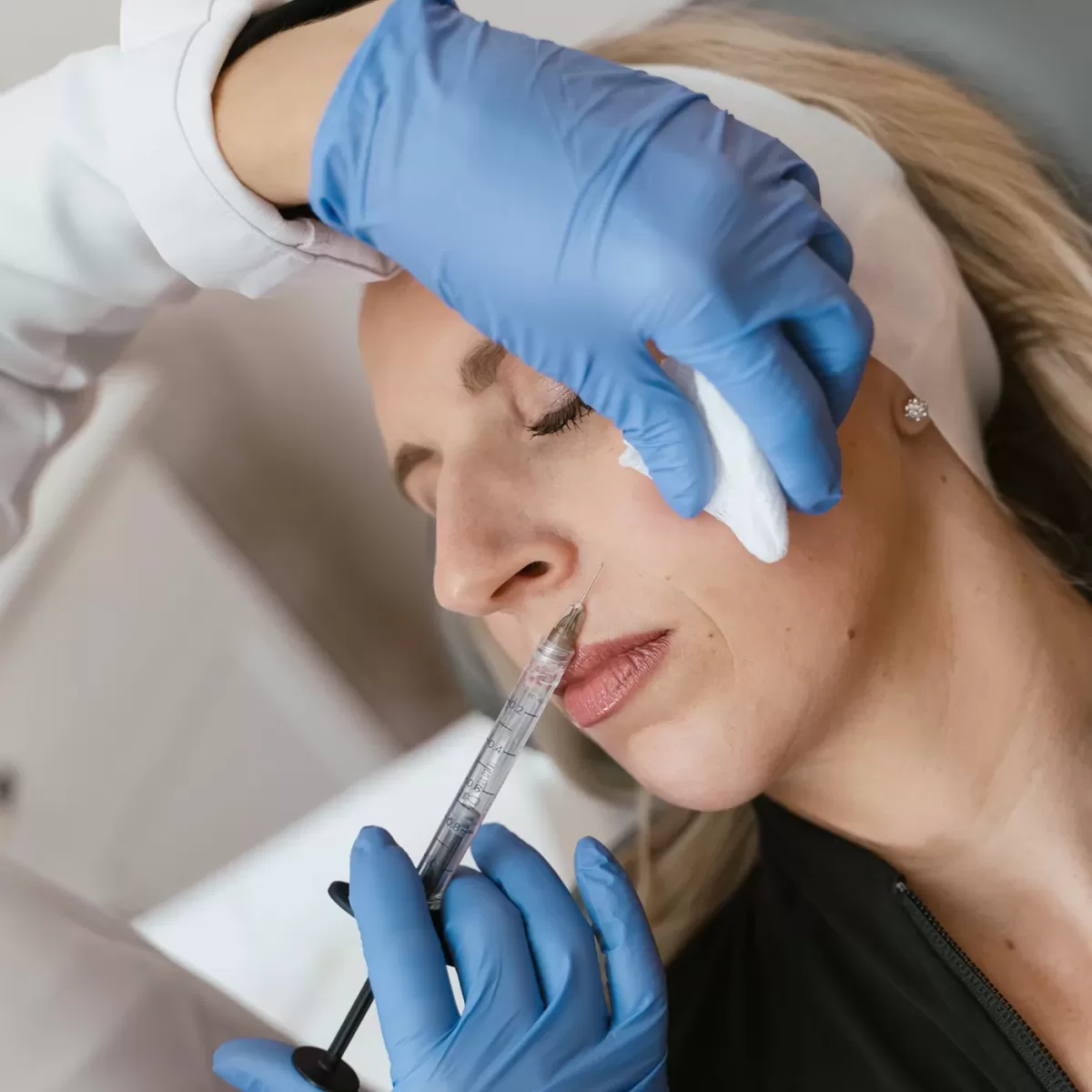 injection specialist injects dermal filler into a female's nasolabial folds for treating smile lines