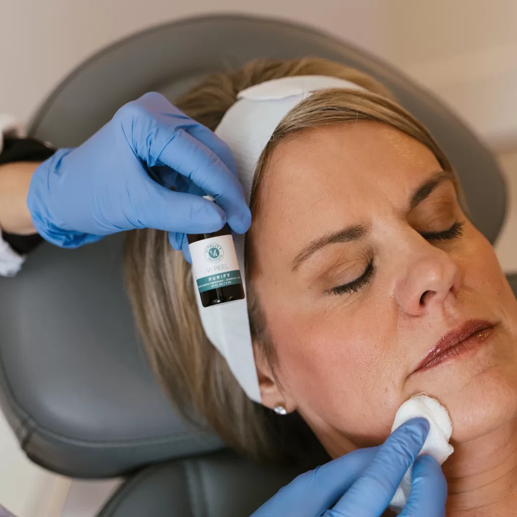 VI Peel solution being applied to female face