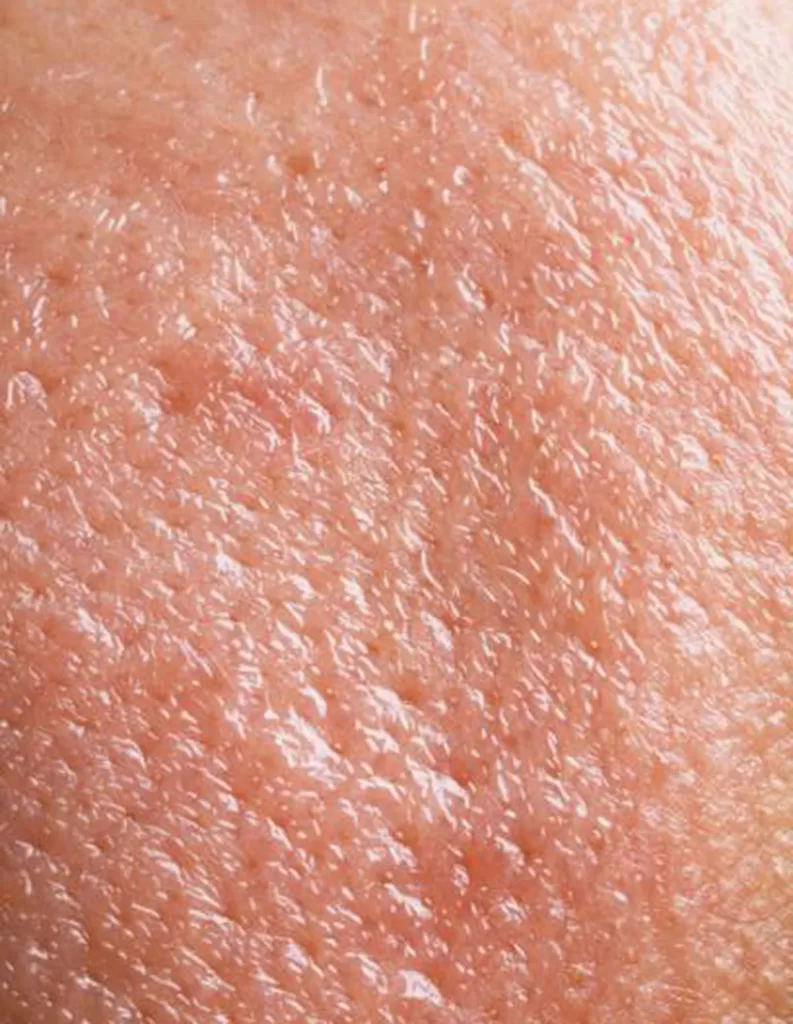 A close up image of combination skin