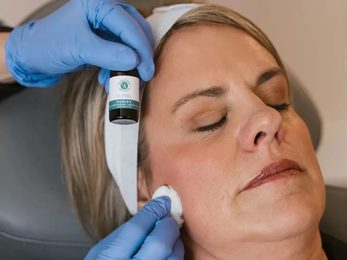 provider applying chemical peel solution on a patients face